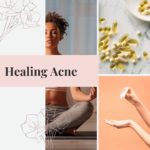 Healing Acne